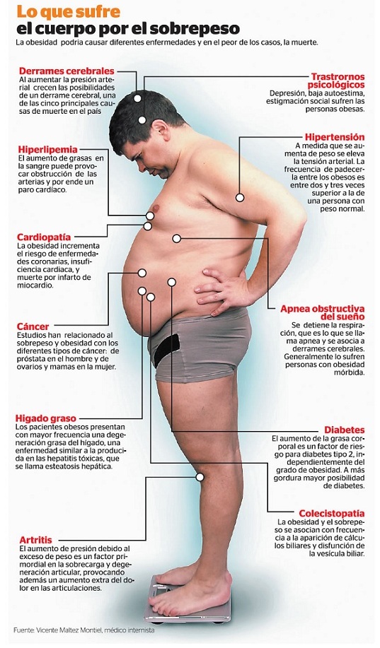 consecuencias-del-sobrepeso